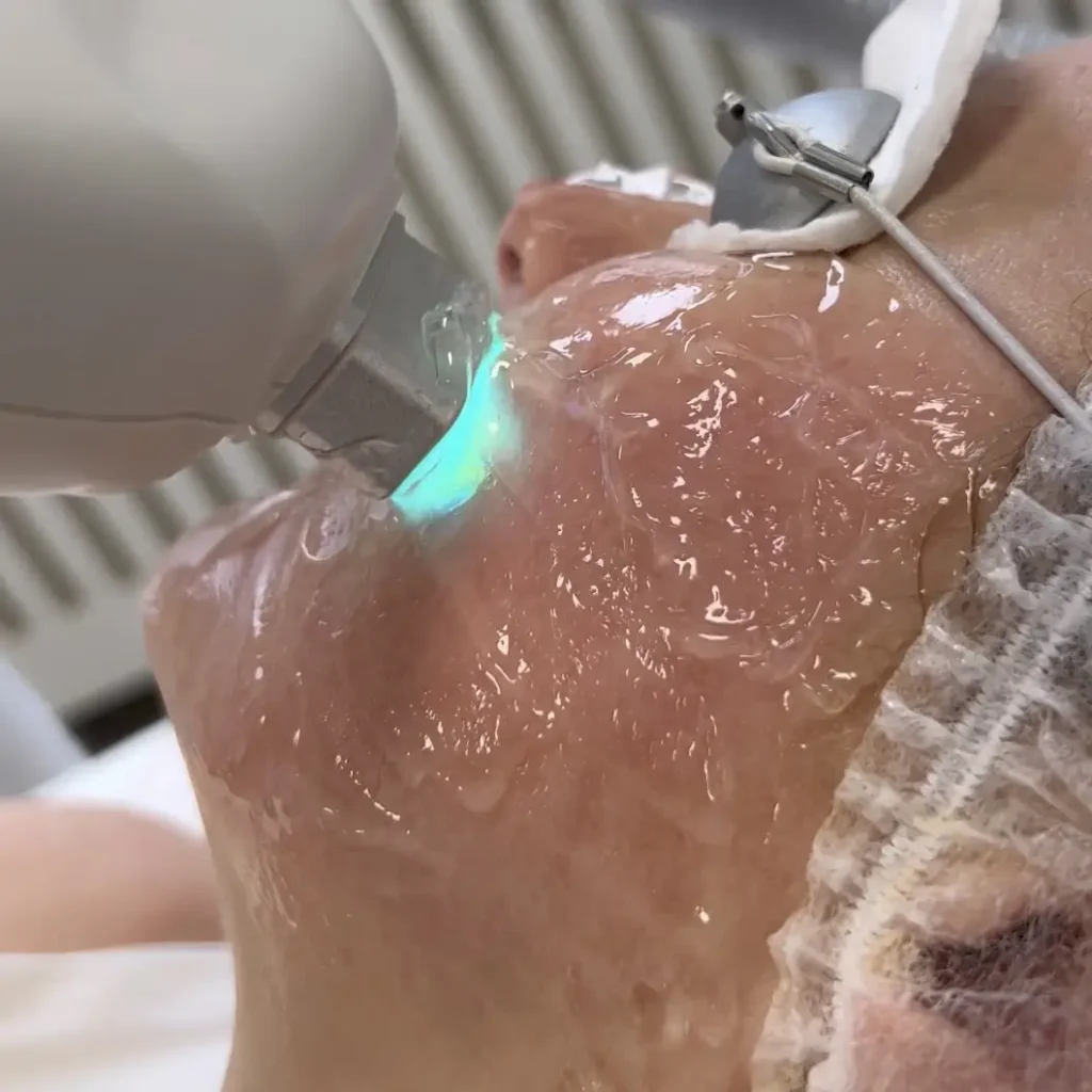 ALMA BABY REJUVE- DYE-VL Gdynia