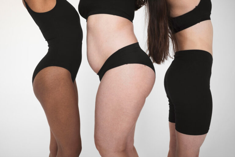 Modelowanie sylwetki przed wiosną: jak zaplanować serię zabiegów na cellulit i jędrność skóry