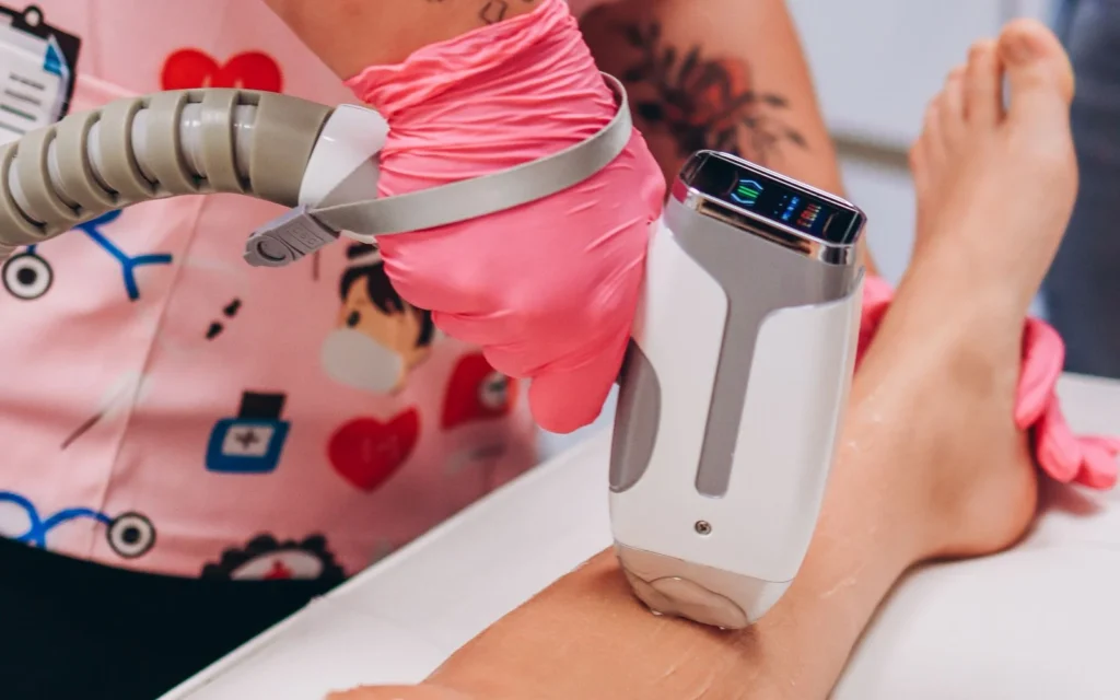 Hirsutyzm i PCOS a depilacja laserowa - co laser może usunąć, a czego nie leczy