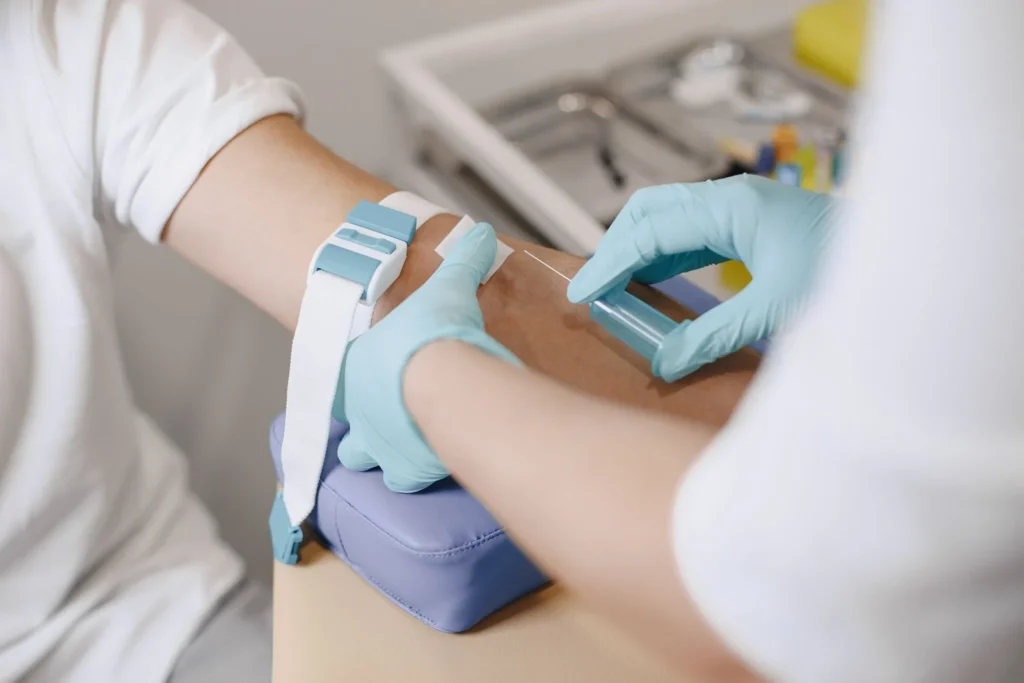 PRP na łysienie androgenowe - co naprawdę pokazują badania i czego terapia nie może obiecać